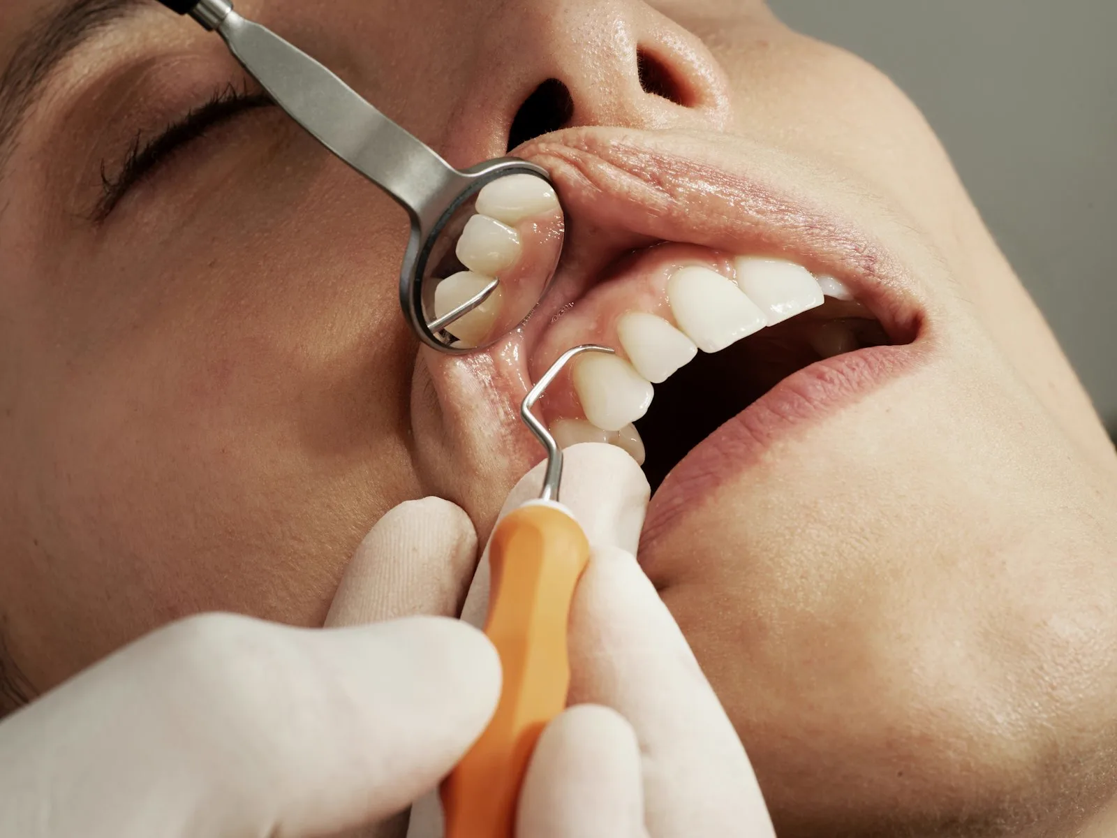 Detalle de una limpieza dental profesional con espejo e instrumental