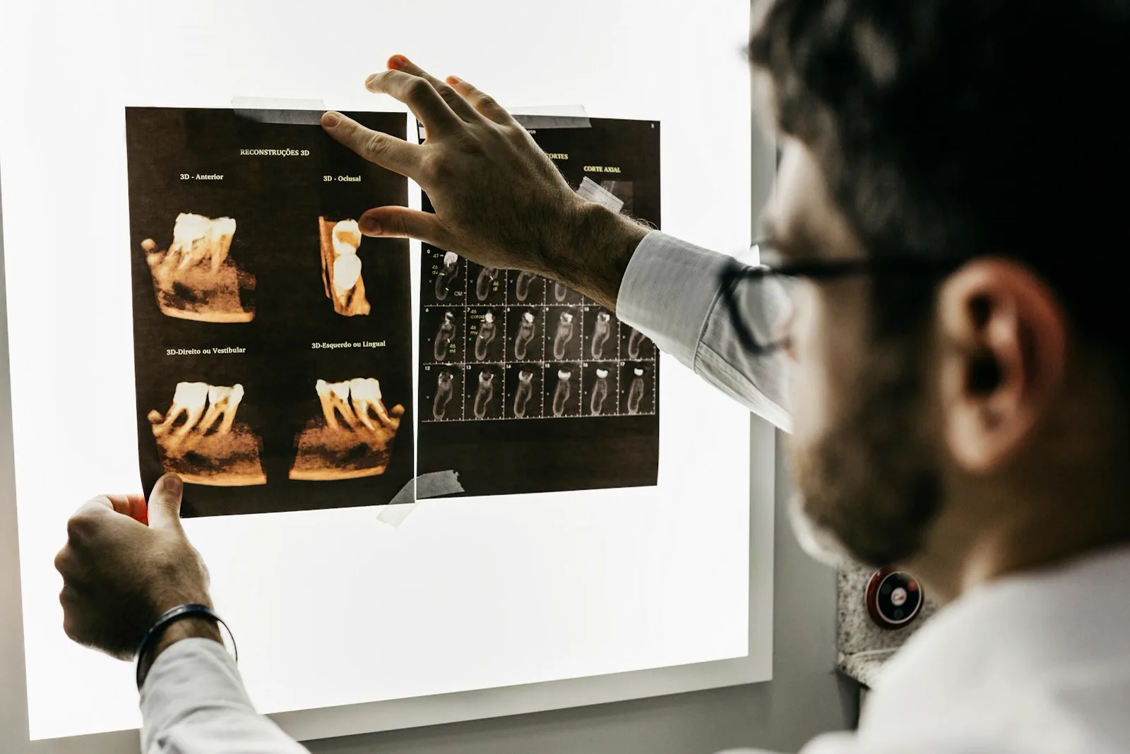 Dentista revisando una radiografía para diagnosticar una caries